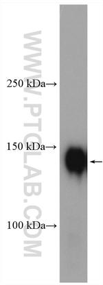 P-selectin Antibody in Western Blot (WB)