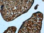 PPBP/NAP2 Antibody in Immunohistochemistry (Paraffin) (IHC (P))