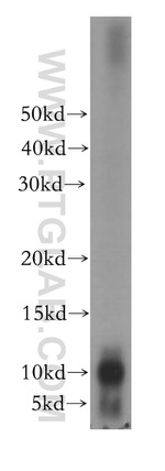 PPBP/NAP2 Antibody in Western Blot (WB)