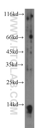 PPBP/NAP2 Antibody in Western Blot (WB)