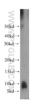 PPBP/NAP2 Antibody in Western Blot (WB)