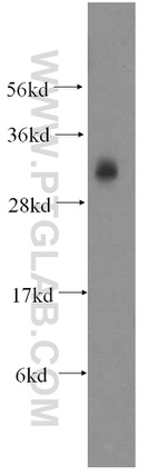 SLD5 Antibody in Western Blot (WB)