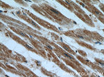 Cytoglobin Antibody in Immunohistochemistry (Paraffin) (IHC (P))