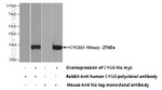 Cytoglobin Antibody in Western Blot (WB)