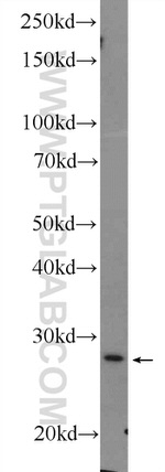 Cytoglobin Antibody in Western Blot (WB)