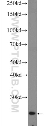 Cytoglobin Antibody in Western Blot (WB)