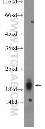 Cytoglobin Antibody in Western Blot (WB)