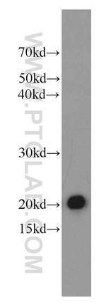 Cytoglobin Antibody in Western Blot (WB)