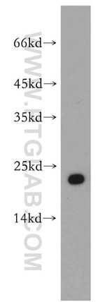 Cytoglobin Antibody in Western Blot (WB)