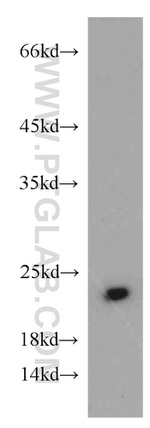 Cytoglobin Antibody in Western Blot (WB)