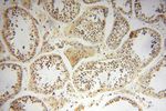 CISD2 Antibody in Immunohistochemistry (Paraffin) (IHC (P))