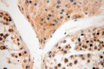 CISD2 Antibody in Immunohistochemistry (Paraffin) (IHC (P))