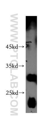 SLC17A5 Antibody in Western Blot (WB)