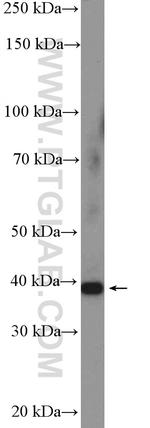 TSG-6 Antibody in Western Blot (WB)