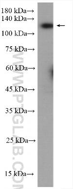 BUB1 Antibody in Western Blot (WB)