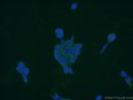 PPP3CB Antibody in Immunocytochemistry (ICC/IF)