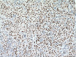 MCM6 Antibody in Immunohistochemistry (Paraffin) (IHC (P))