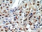 MCM6 Antibody in Immunohistochemistry (Paraffin) (IHC (P))