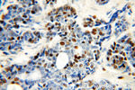 MCM6 Antibody in Immunohistochemistry (Paraffin) (IHC (P))