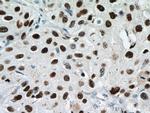 MCM6 Antibody in Immunohistochemistry (Paraffin) (IHC (P))