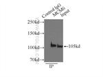 MCM6 Antibody in Immunoprecipitation (IP)