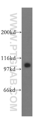 MCM6 Antibody in Western Blot (WB)