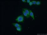 GNA14 Antibody in Immunocytochemistry (ICC/IF)