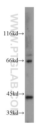 GNA14 Antibody in Western Blot (WB)