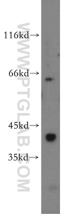 GNA14 Antibody in Western Blot (WB)