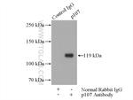 p107 Antibody in Immunoprecipitation (IP)