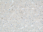 RAB39 Antibody in Immunohistochemistry (Paraffin) (IHC (P))