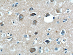 RAB39 Antibody in Immunohistochemistry (Paraffin) (IHC (P))