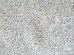 RAB39 Antibody in Immunohistochemistry (Paraffin) (IHC (P))