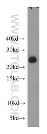 RAB39 Antibody in Western Blot (WB)