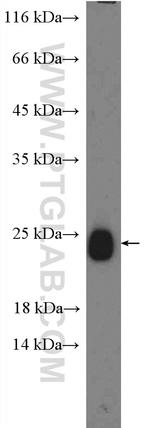 RAB39 Antibody in Western Blot (WB)