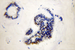 RAD17 Antibody in Immunohistochemistry (Paraffin) (IHC (P))