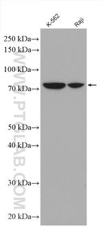 RAD17 Antibody in Western Blot (WB)