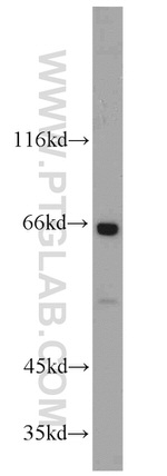 Glycerokinase Antibody in Western Blot (WB)