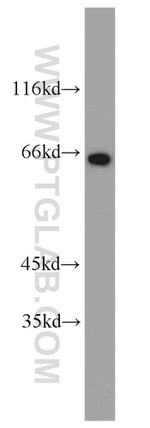 Glycerokinase Antibody in Western Blot (WB)