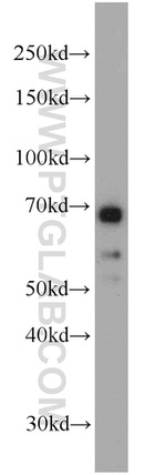 Glycerokinase Antibody in Western Blot (WB)