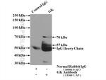 Glycerokinase Antibody in Immunoprecipitation (IP)