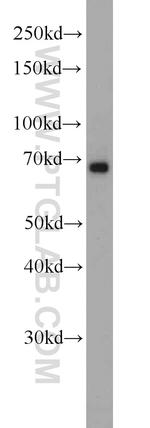 Glycerokinase Antibody in Western Blot (WB)