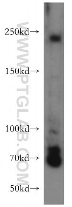 PIP5K3 Antibody in Western Blot (WB)