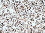 CYP11A1 Antibody in Immunohistochemistry (Paraffin) (IHC (P))