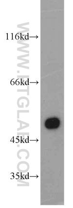 CYP11A1 Antibody in Western Blot (WB)