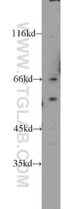 LMAN1 Antibody in Western Blot (WB)