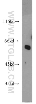 LMAN1 Antibody in Western Blot (WB)