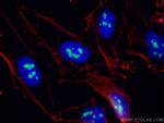 NAT10 Antibody in Immunocytochemistry (ICC/IF)