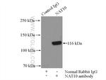 NAT10 Antibody in Immunoprecipitation (IP)