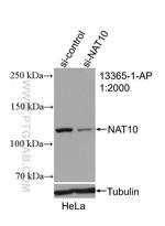 NAT10 Antibody in Western Blot (WB)